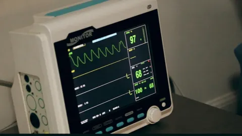 Pemeriksaan EKG Elektrokardiografi